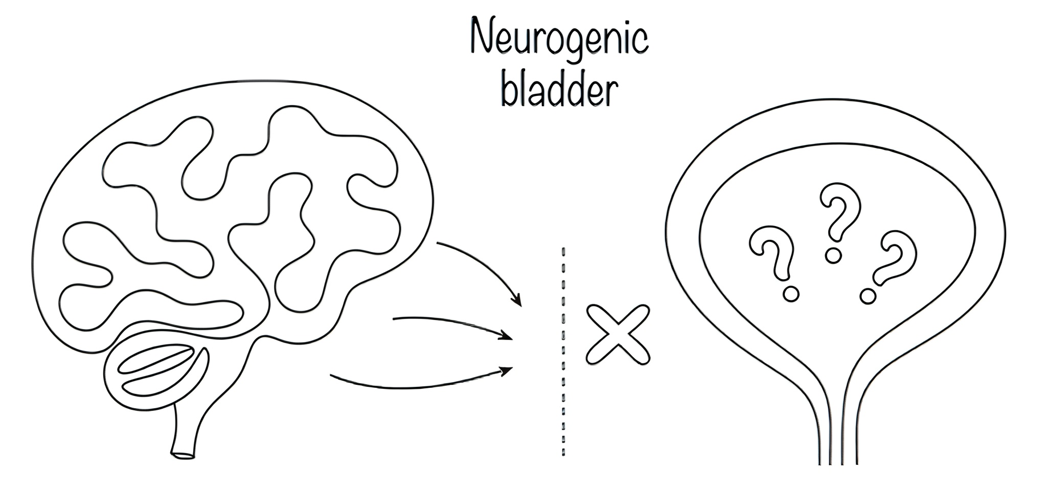 neurogenic bladder (2)