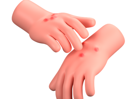 Food-Induced Allergic Reactions Needing ED Visit on the Rise in Infants