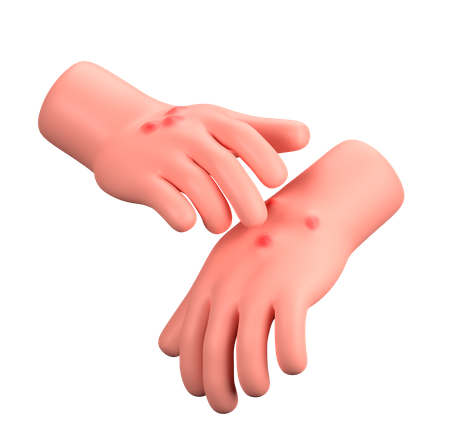 Food-Induced Allergic Reactions Needing ED Visit on the Rise in Infants