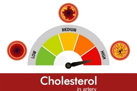 Prevention starts at a young age… New guidelines and tips for managing cholesterol
