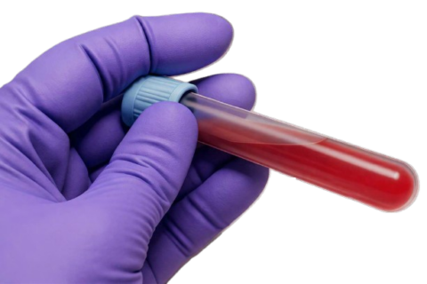 Your Doctor Might Be Using The Wrong Test To Track Your Cholesterol, Study Says