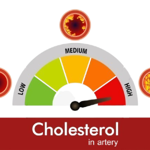 High Cholesterol: A Silent Threat to Heart Health